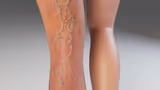 Recommended image1