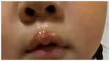 Recommended image1