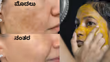 Recommended image1