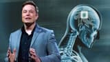 Elon Musk: మనిషి మెదడులో ఎలక్ట్రానిక్‌ చిప్ .. మరో సంచలనానికి ఎలాన్ మస్క్ శ్రీకారం.. 