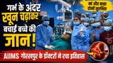 जन्म से पहले ही बच्चे का ऑपरेशन! AIIMS गोरखपुर के डॉक्टरों ने कर दिखाया चमत्कार