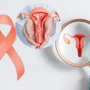 How Weight Gain Raises Uterine Cancer Risk – Early Signs You Shouldn’t Miss