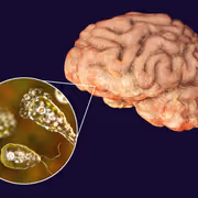 9-Year-Old Kerala Girl Dies From Rare Brain-Eating Amoeba Infection: Symptoms, Treatment & More
