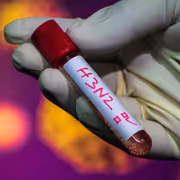 Delhi Battles Rising H3N2 Cases: Guidelines, Precautions and Key Updates
