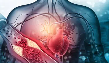 High Cholesterol: கொலஸ்ட்ரால் எகிறிவிட்டதா..? உடல் சொல்லும் ஷாக்கிங் அறிகுறிகள்..!