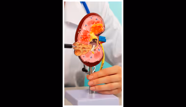 Kidney Health : किडनी निरोगी ठेवायचीय? रोजच्या आहारात घ्या हे ६ सुपरफूड्स