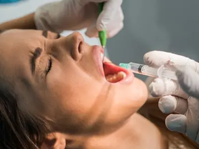 What are lip fillers