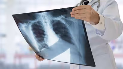 Some symptoms of Tuberculosis