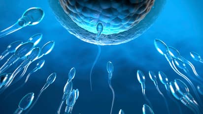 Male Infertility