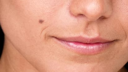 palmistry-mole-on-face