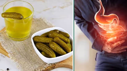 pickle juice benefits in acid reflux