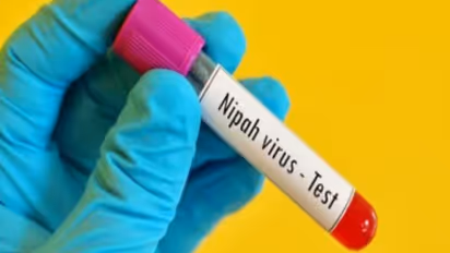 Nipah Virus
