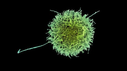 Genetic tweaks make natural killer cells stronger against cancer