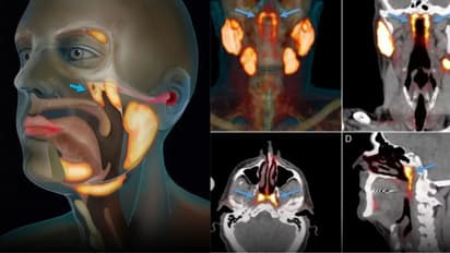 Scientists Find New Organ In Human Body