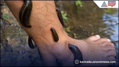 Leeches