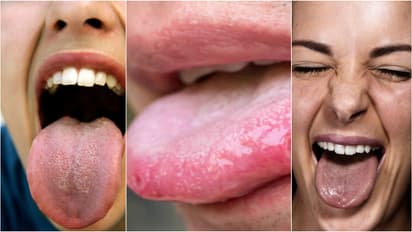 Tongue Color