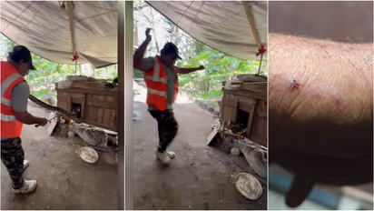 snake bite snake catcher