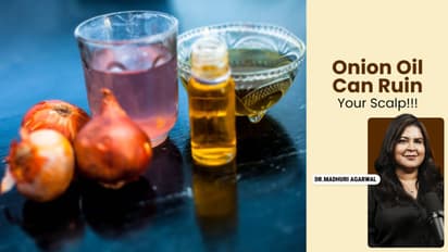 does onion oil really regrow hair