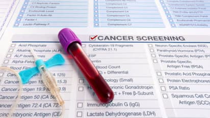 cancer tests for 60 plus senior citizens