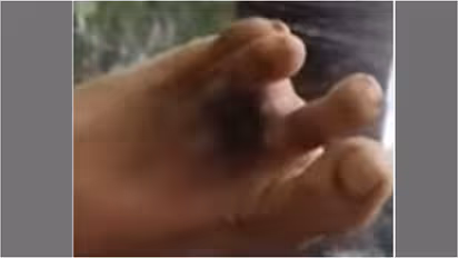 finger