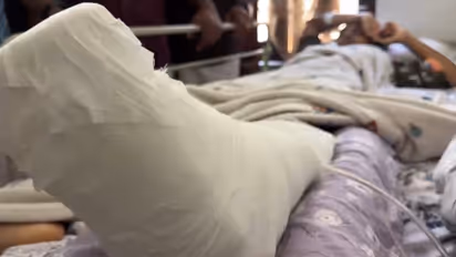 family struggles to fund further treatment for girl run over by ksrtc bus in thiruvambady