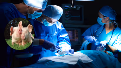 human pig liver surgery