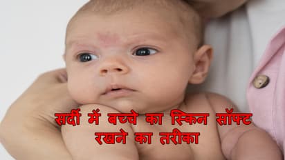 Winter Beby Skin Care