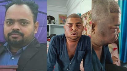 Kanpur hair transplant death