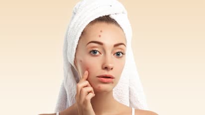 Disease-symptoms-on-face