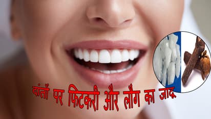Teeth Care Tips