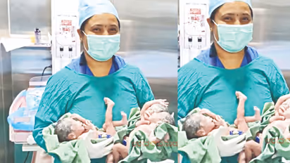 A woman name of renuka ganachari from Belagavi has given birth to triplets