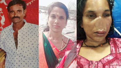 Davanagere wife Nose cut