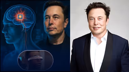 Canada Neuralink surgery