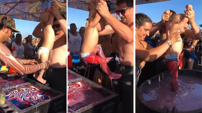 Viral Baby Body Marbling Video Divides Social Media as Users Question Chemical Safety