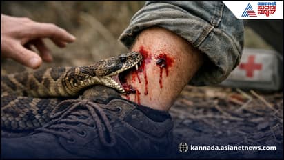 snake bite