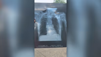 XRAY konni medical college
