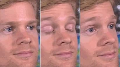 Bright Side Stories: Drew Scanlon's simple blink changed everything - Blinking Guy