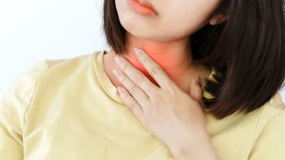 head and neck cancer