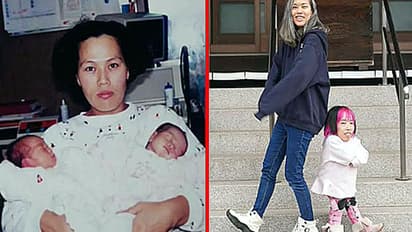 unusual twins with weird height difference2