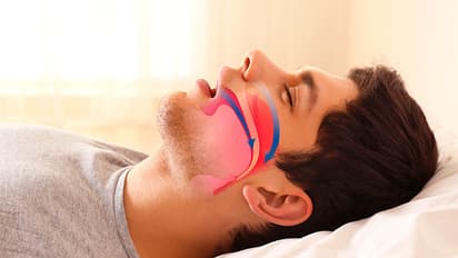 how to get rid of snoring