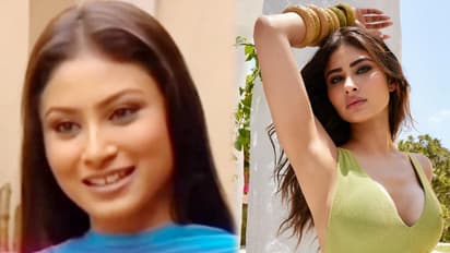 Mouni Roy Plastic Surgery