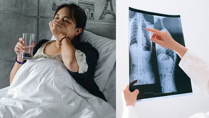 World lung cancer day 2023