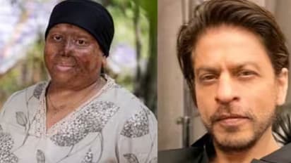 acid-attack-survivor-seek-help-from-shahrukh-khan