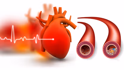 Heart Blockage Ayurvedic Therapy