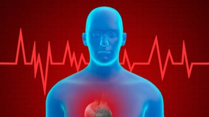 UK Man Died Due to Heart Attack