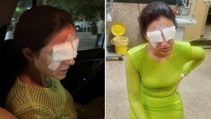 Jasmin Bhasin Eye Damage