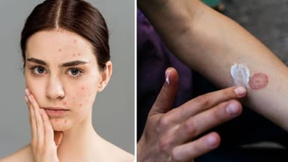 diabetic skin problems