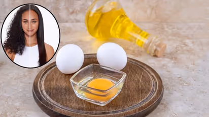 egg hair mask for dandruff and frizz free hair