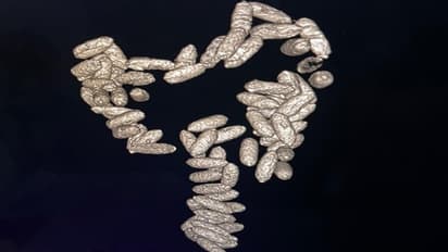 Kenya Woman Ingests Cocaine Capsules