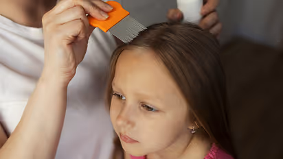 How-to-get-rid-of-lice-from-kids-hair
